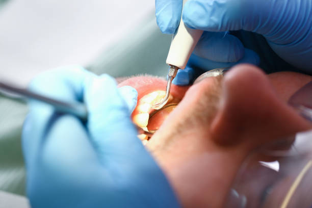 Best Emergency Treatment for Dental Infections or Abscesses in Mckinney, TX